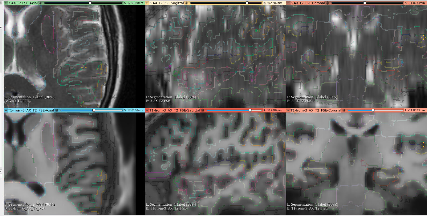 Parcellation on T2