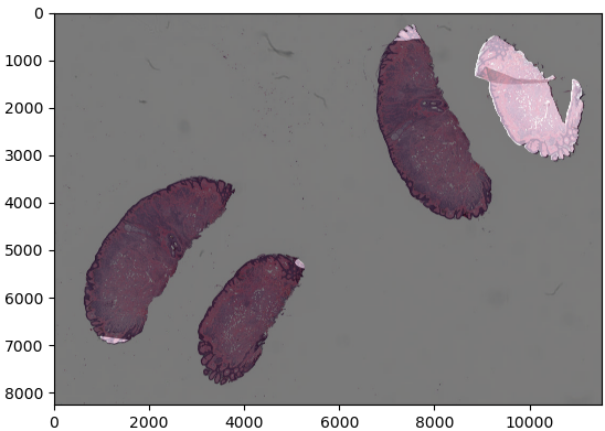 pw38-dicom-wsi-conversion-and-model