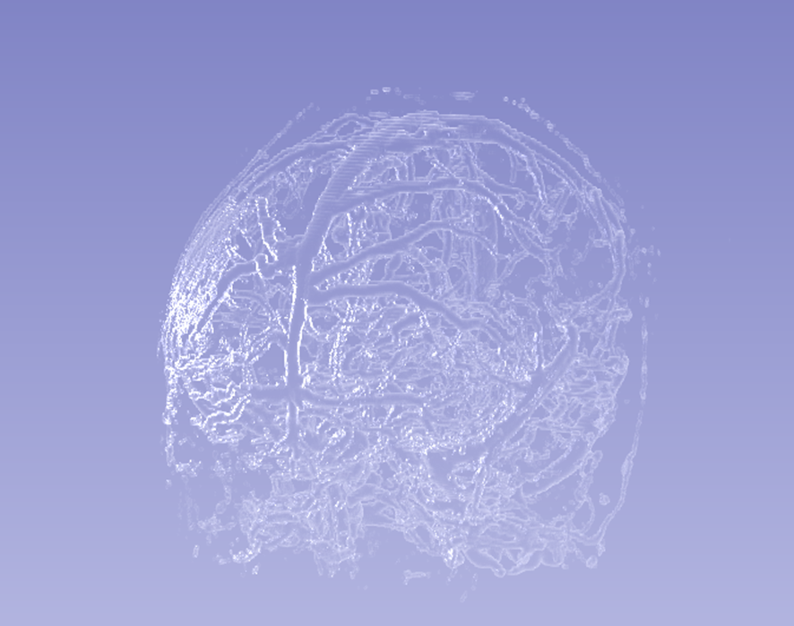 Glass effect on brain vessels